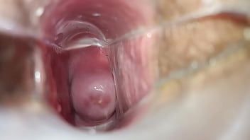 Play Speculum inside pussy